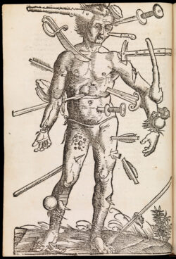 Sixteenth-century Wound Man illustration showing a standing figure pierced and injured by numerous weapons.
